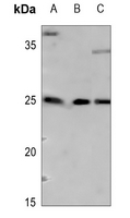 WB - Anti-ARF4 Antibody AP59969